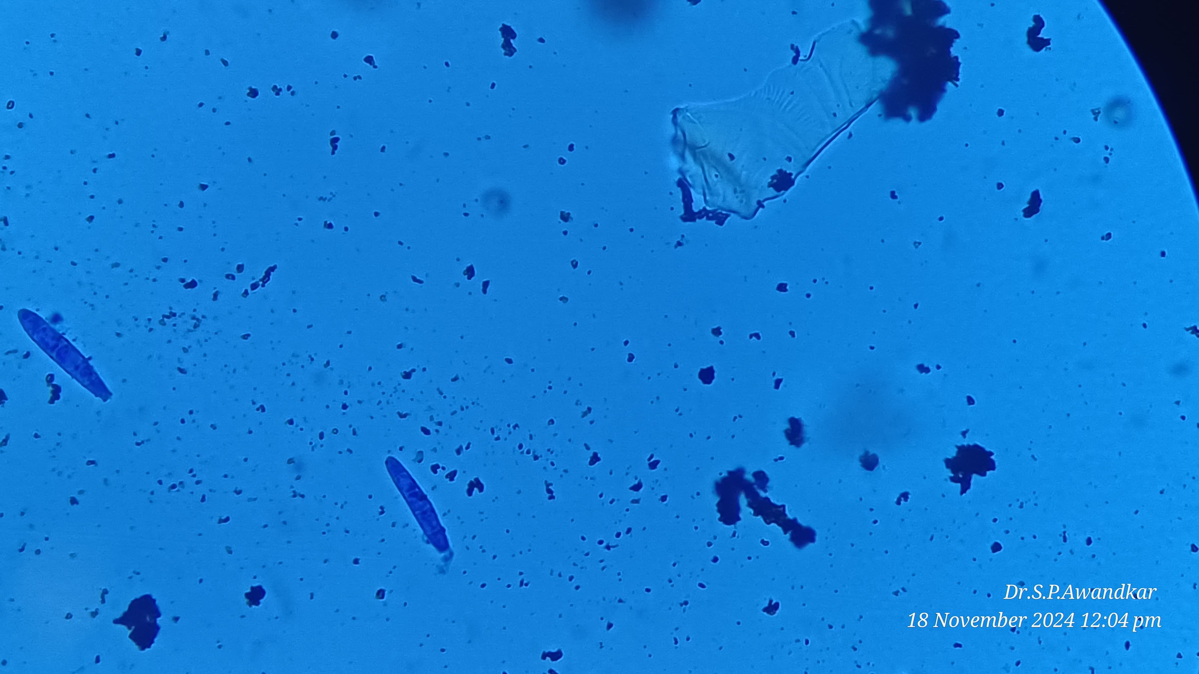 35. Trichophyton Macrospores